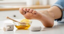 Quick Ways to Heal Dry Cracked Heels at Home Using Safe and Effective Kitchen Ingredients